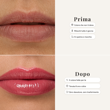 ROSSETTO PH NIVERA™ - Limited Edition